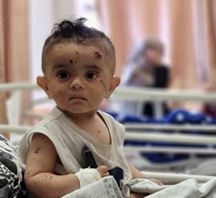 أطفالنا اللطماء في غزة