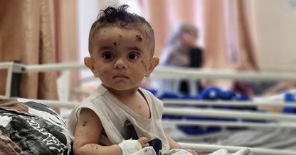 أطفالنا اللطماء غزة