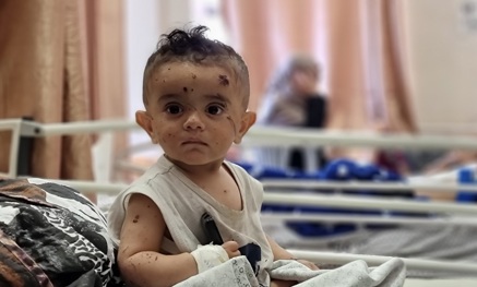 أطفالنا اللطماء غزة