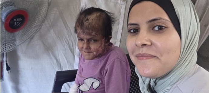بدء فريق هيومان أبيل على الأرض في غزة بتقديم الرعاية لريما