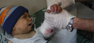 أطفالنا اللطماء في غزة