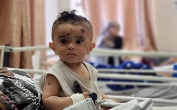 صندوق رعاية أطفالنا اللطماء في غزة