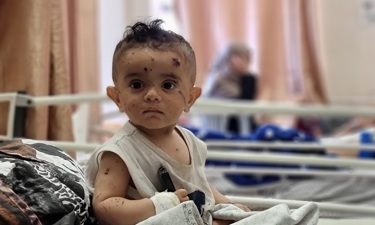 صندوق رعاية أطفالنا اللطماء في غزة